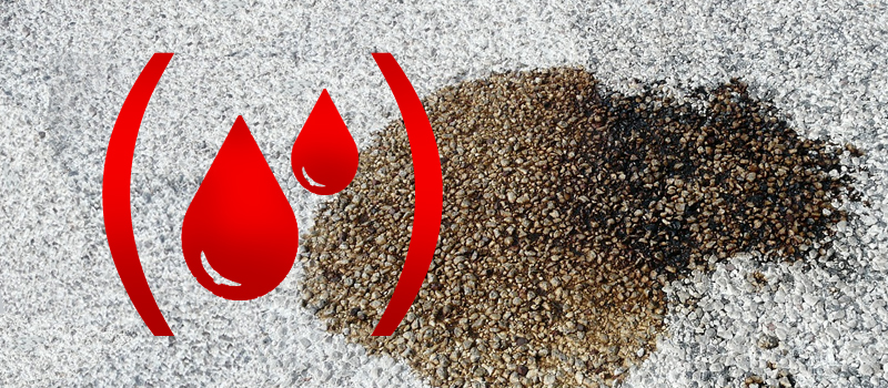 Wyciek oleju ze skrzyni